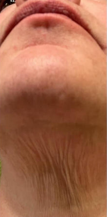 Before - Comentarios