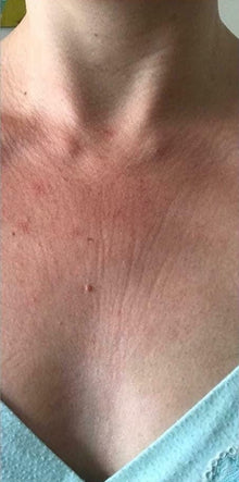 Before - Comentarios