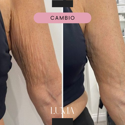 Crema Antiarrugas - Luma